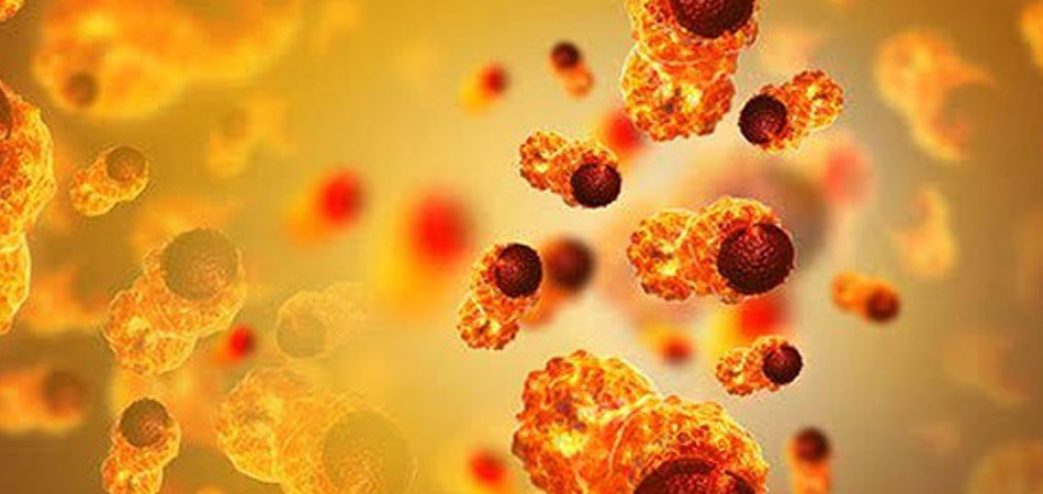 Cheap and Affordable Cancer Treatment in India, Best Hospitals for  Cancer Treatment in India, Best Doctors for Cancer Treatment in India , Medkaizen Global, Apollo Hospitals, Fortis Hospitals, Max Hospitals, Artemis Hospitals, Medanta Hospitals, Manipal Hospitals, Hospitals for Medical Tourism in India, Hospital for Medical Treatment in India, Hospitals for Surgery in India, Medical Tourism in India, Medical Treatment in India, Surgery in India, Medical Tourism Company