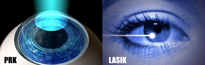 Cheap and Affordable Eye Treatment in India, Best Hospitals for Eye Treatment in India, Best Doctors for Eye Treatment in India , Medkaizen Global, Apollo Hospitals, Fortis Hospitals, Max Hospitals, Artemis Hospitals, Medanta Hospitals, Manipal Hospitals, Hospitals for Medical Tourism in India, Hospital for Medical Treatment in India, Hospitals for Surgery in India, Medical Tourism in India, Medical Treatment in India, Surgery in India, Medical Tourism Company