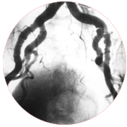 Cheap and Affordable Heart Surgery in India, Best Hospitals for Heart Surgery in India, Best Doctors for Heart Surgery in India , Medkaizen Global, Apollo Hospitals, Fortis Hospitals, Max Hospitals, Artemis Hospitals, Medanta Hospitals, Manipal Hospitals, Hospitals for Medical Tourism in India, Hospital for Medical Treatment in India, Hospitals for Surgery in India, Medical Tourism in India, Medical Treatment in India, Surgery in India, Medical Tourism Company