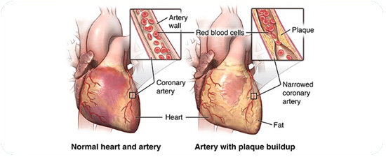 Cheap and Affordable Heart Surgery in India, Best Hospitals for Heart Surgery in India, Best Doctors for Heart Surgery in India , Medkaizen Global, Apollo Hospitals, Fortis Hospitals, Max Hospitals, Artemis Hospitals, Medanta Hospitals, Manipal Hospitals, Hospitals for Medical Tourism in India, Hospital for Medical Treatment in India, Hospitals for Surgery in India, Medical Tourism in India, Medical Treatment in India, Surgery in India, Medical Tourism Company