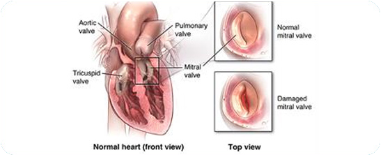 Cheap and Affordable Heart Surgery in India, Best Hospitals for Heart Surgery in India, Best Doctors for Heart Surgery in India , Medkaizen Global, Apollo Hospitals, Fortis Hospitals, Max Hospitals, Artemis Hospitals, Medanta Hospitals, Manipal Hospitals, Hospitals for Medical Tourism in India, Hospital for Medical Treatment in India, Hospitals for Surgery in India, Medical Tourism in India, Medical Treatment in India, Surgery in India, Medical Tourism Company