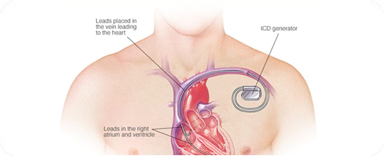 Cheap and Affordable Heart Surgery in India, Best Hospitals for Heart Surgery in India, Best Doctors for Heart Surgery in India , Medkaizen Global, Apollo Hospitals, Fortis Hospitals, Max Hospitals, Artemis Hospitals, Medanta Hospitals, Manipal Hospitals, Hospitals for Medical Tourism in India, Hospital for Medical Treatment in India, Hospitals for Surgery in India, Medical Tourism in India, Medical Treatment in India, Surgery in India, Medical Tourism Company