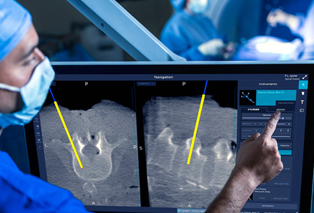 Cheap and Affordable Spine Surgery in India, Best Hospitals for Spine Surgery in India, Best Doctors for Spine Surgery in India , Medkaizen Global, Apollo Hospitals, Fortis Hospitals, Max Hospitals, Artemis Hospitals, Medanta Hospitals, Manipal Hospitals, Hospitals for Medical Tourism in India, Hospital for Medical Treatment in India, Hospitals for Surgery in India, Medical Tourism in India, Medical Treatment in India, Surgery in India, Medical Tourism Company